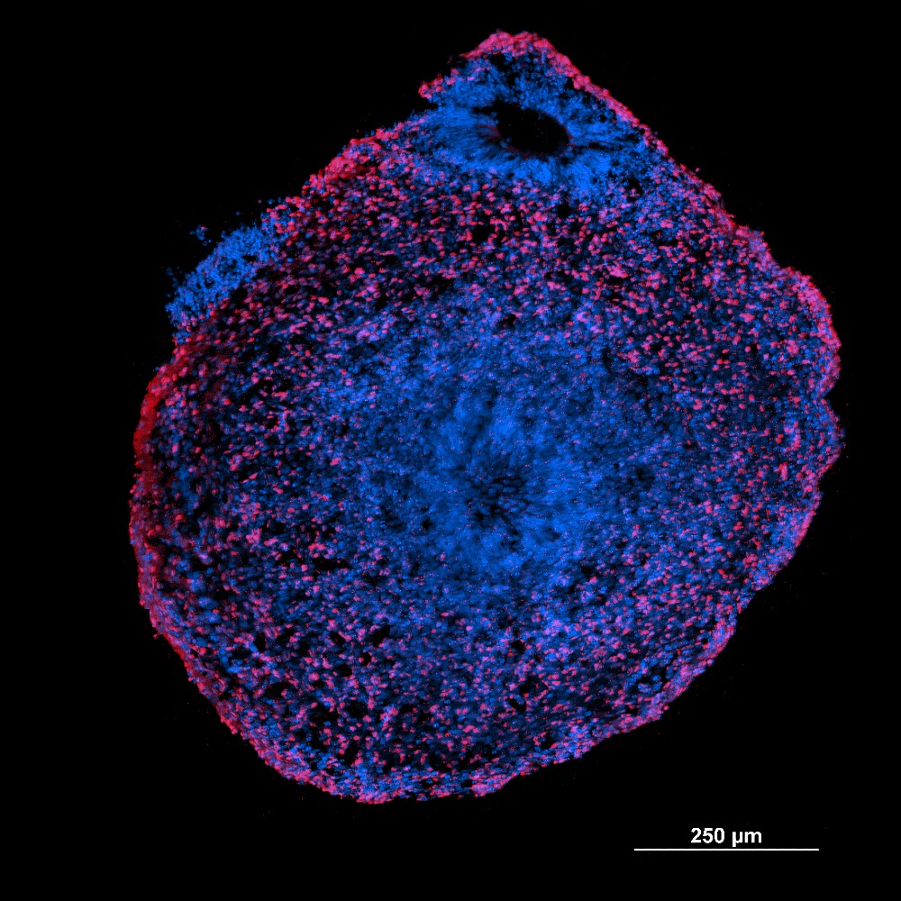 Confocal Microscope